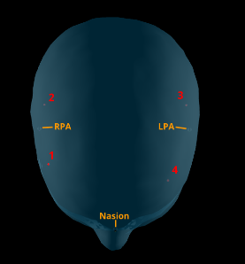 Real-time Head Monitoring - MNE-CPP